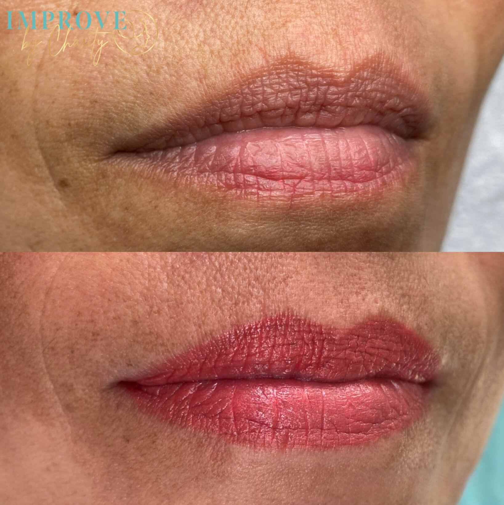 Full Lips Healed Full Lips Healed