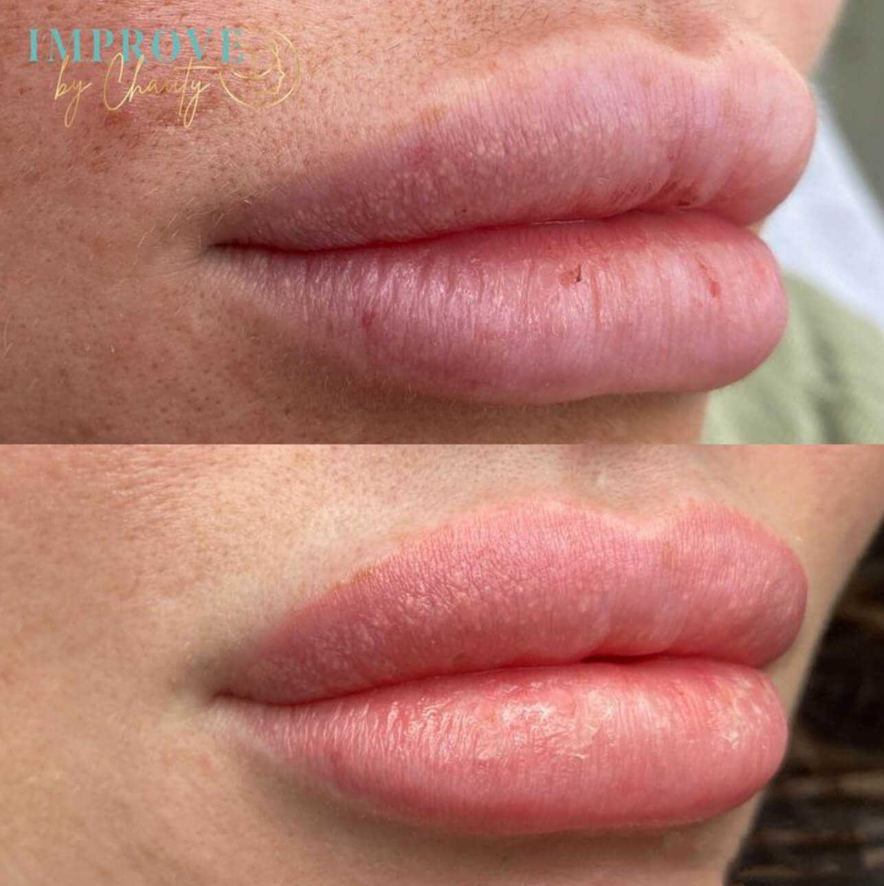 Lip Blush Healed Lip Blush Healed