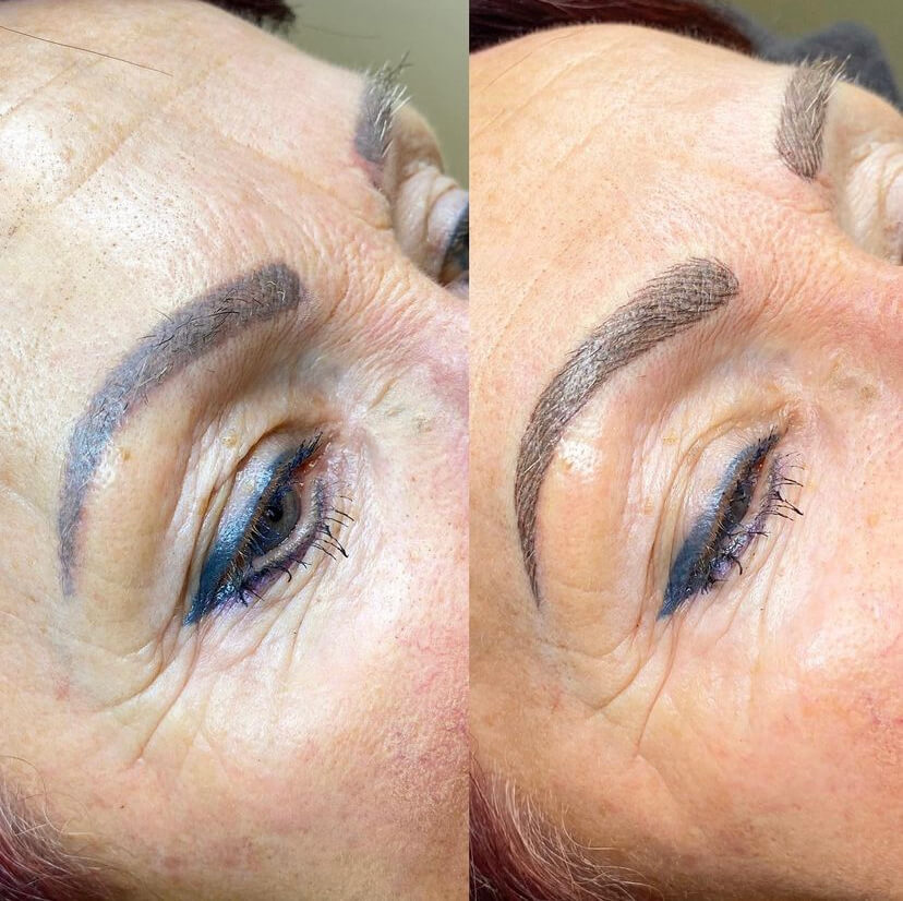 Ontdek welke correctiebehandelingen mogelijk zijn om jouw permanente make-up te herstellen.