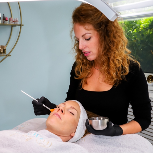 Medische peeling behandeling voor een frisse en egale huid bij IMPROVE by Charity in Amstelveen