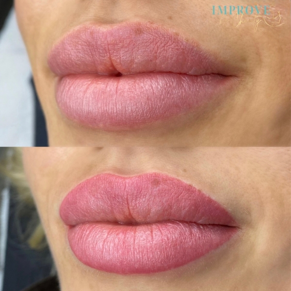 Natuurlijk resultaat van permanente make-up lippen met een zachte kleur en strakke lipcontouren.