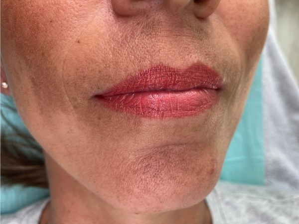 Natuurlijk resultaat na een PMU lippen behandeling met meer symmetrie en een verzorgde uitstraling.