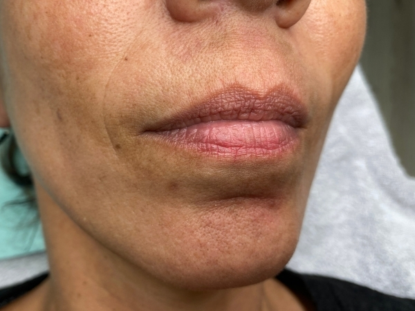 Natuurlijke lippen vóór een PMU behandeling voor meer kleur en symmetrie.