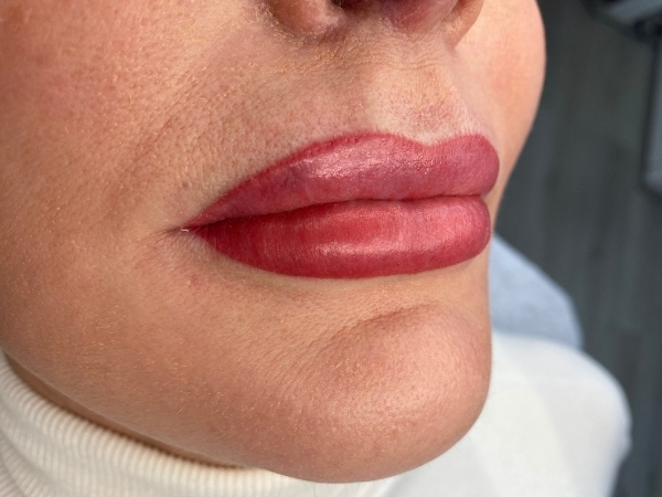 Resultaat na een PMU lipcorrectie met een zachtere kleur en natuurlijk ogende lippen.