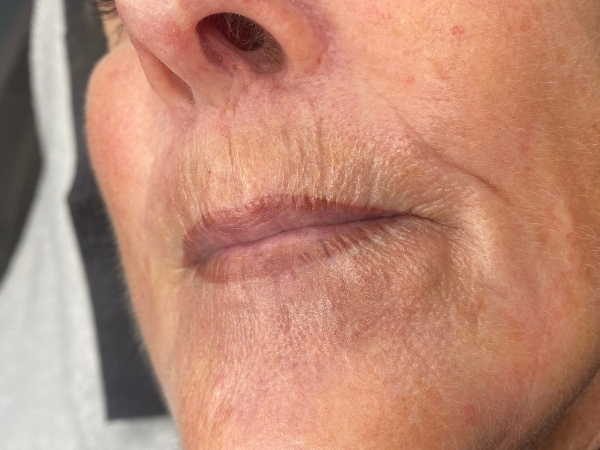 Nafoto van lippen na een PMU lipcorrectie met een natuurlijkere kleur en vorm.