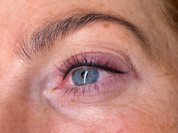 Resultaat na een PMU oogcorrectie waarbij de vorm en kleur van de eyeliner zijn verbeterd.