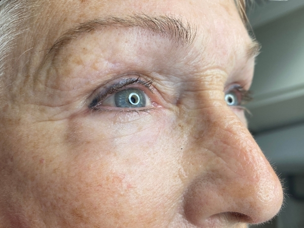 Voorfoto van de ogen vóór een behandeling met permanente eyeliner.