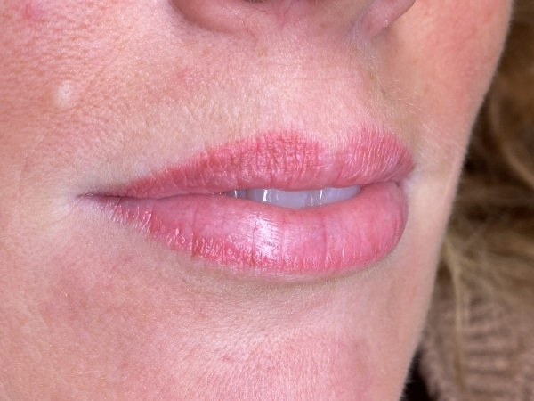 Voorfoto van vervaagde permanente make-up op de lippen vóór een correctiebehandeling.