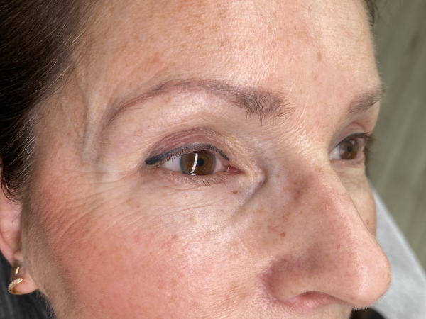 Voorfoto van een bestaande permanente eyeliner vóór een PMU oogcorrectie.