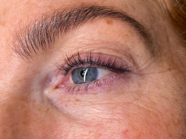 Voorfoto van een oude permanente eyeliner vóór een correctiebehandeling.